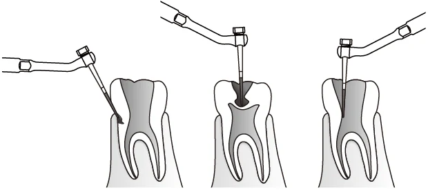 Применение насадки ED9 с борами.webp