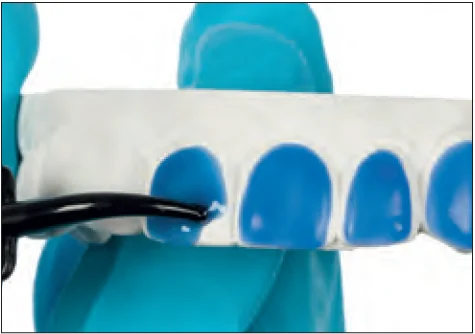 Ultradent LC Block-Out фото 1 Ultradent LC Block-Out фото 1.webp