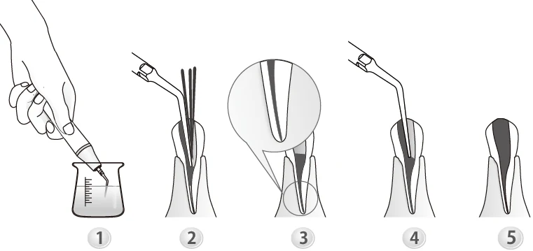 Применение насадки E3.webp