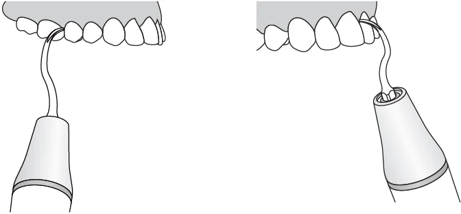 Применение насадки G9.webp