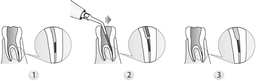Применение насадки E3D.webp