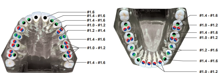 Система дрилей и стекловолоконных штифтов Matchpost от компании RTD.webp