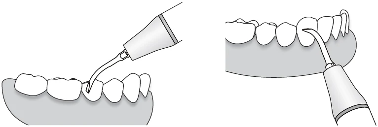 Применение насадки G6.webp