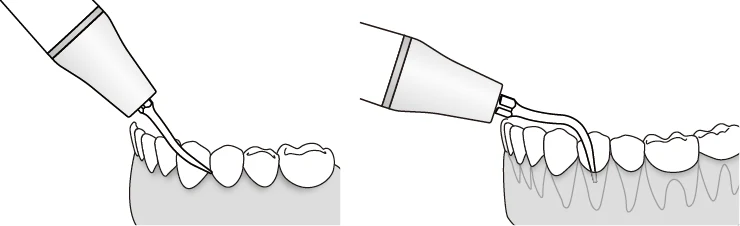 Применение насадки P4.webp