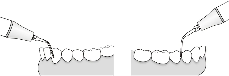 Применение насадки G3.webp