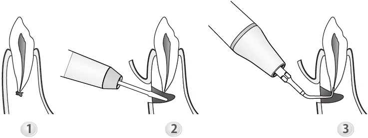Применение насадки ED10.webp