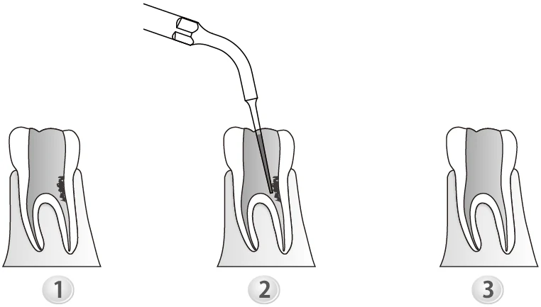 Применение насадки ED5D.webp