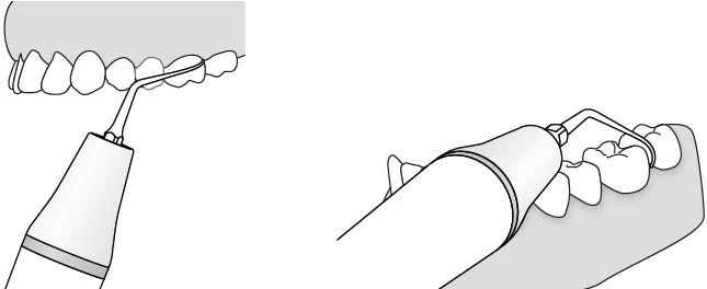 Применение насадки P2L.webp