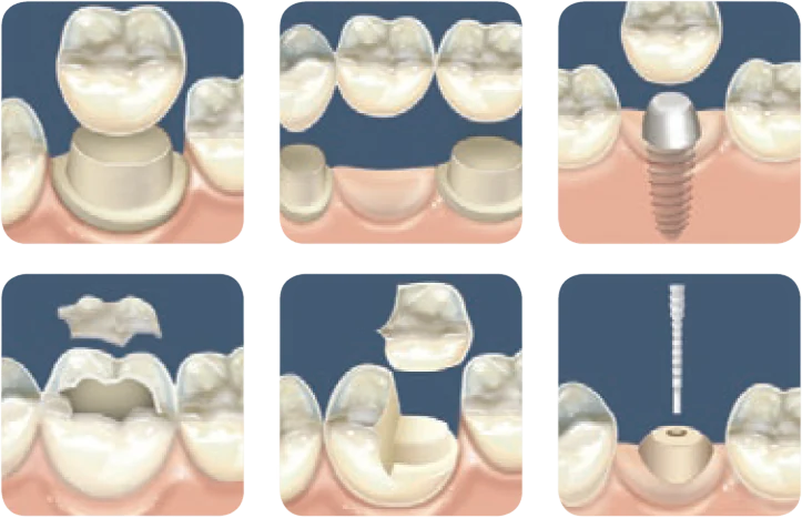 Nexus RMGI примеры показаний к применению Nexus RMGI примеры показаний к применению.webp