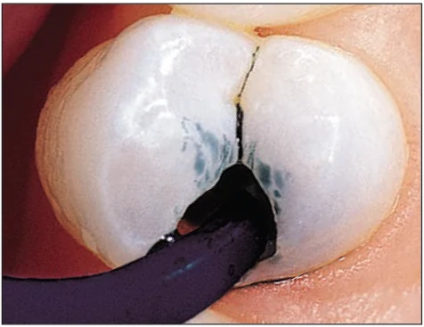 Нанесение индикатора Sable Seek насадкой Black Mini Brush Tip.webp