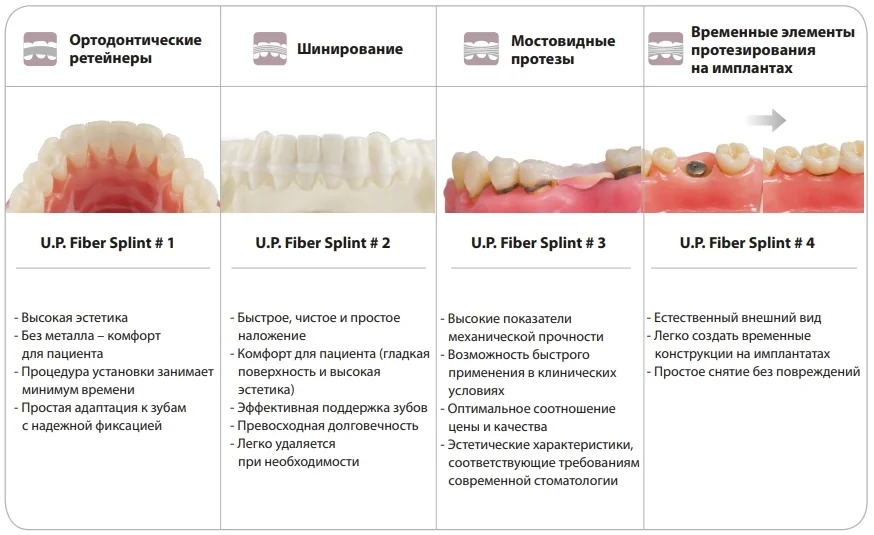 Варианты клинического применения U.P. Fiber Splint Варианты клинического применения U.P. Fiber Splint.webp
