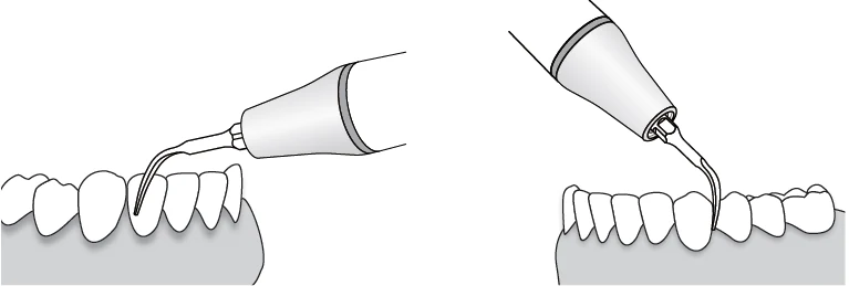 Применение насадки G4.webp