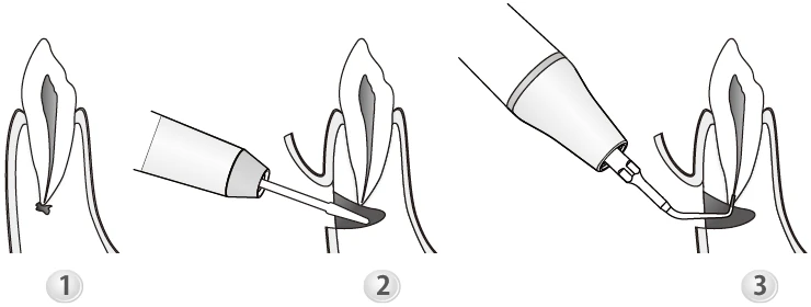 Применение насадки E10D.webp