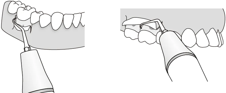 Применение насадки P2RD.webp