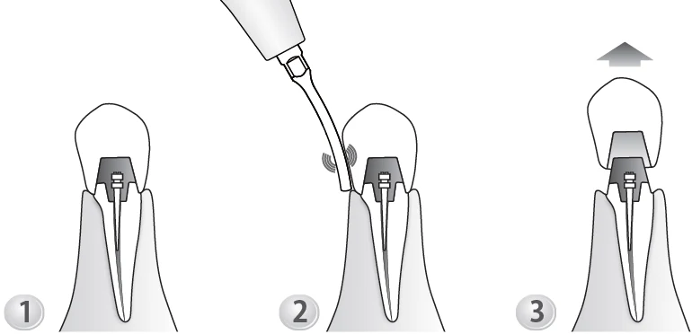 Применение насадки G7.webp