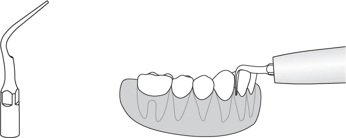 Насадка P5 применение
