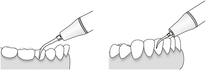 Применение насадки GD5.webp