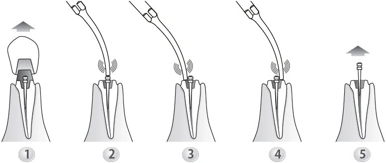 Применение насадки G8.webp