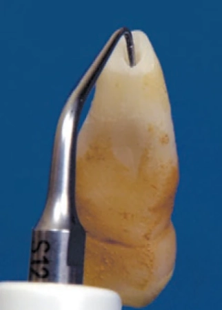 насадка s12-70d endosurgery для скалера, 70°, универсальная, для апикальной хирургии, acteon