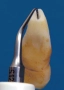 насадка s12-70d endosurgery для скалера, 70°, универсальная, для апикальной хирургии, acteon