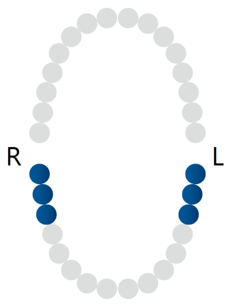 кламп для "раббердама" № 56 rubber dam clamp, dentech corporation