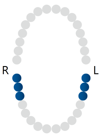 кламп для "раббердама" №7 black rubber dam clamp, dentech corporation