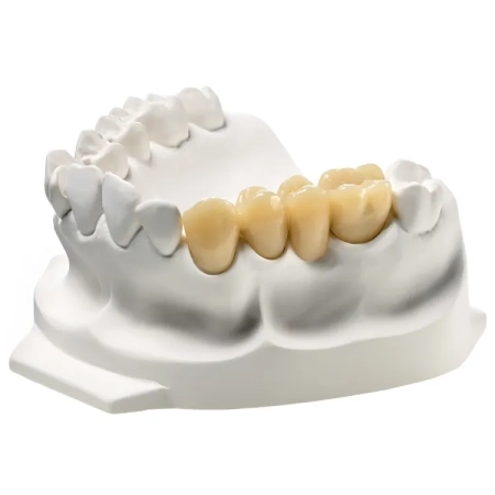 акритемп (acrytemp) a1 - самополимеризующаяся пластмасса для коронок и мостов, 50мл - 4:1, zhermack