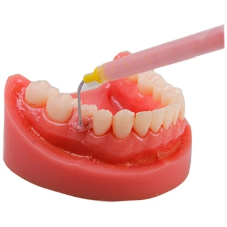 наконечники интраоральные core oral tip-y s119 (50 шт) seil global