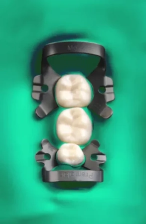 латексные листы dental dam зеленый, плотный, 152 мм х 152 мм, мята (36 шт) sanctuary