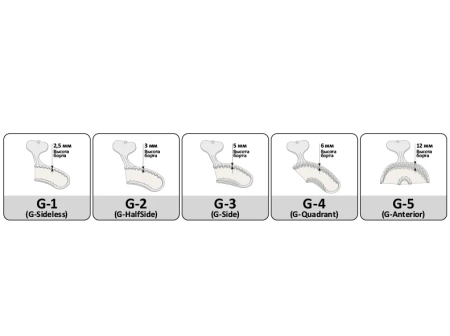 ложки слепочные bitetray g1 sideless частичные сетчатые (50 шт) spident