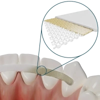 dentapreg sfm - лента для шинирования 50мм*2мм*0.3мм (1 шт) adm