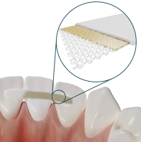 dentapreg pfm - лента для шинирования 50мм*3мм*0.3мм (1 шт) adm