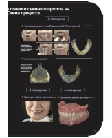 suction denture. идеальное руководство. автор: кацуси сато