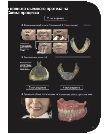 suction denture. идеальное руководство. автор: кацуси сато
