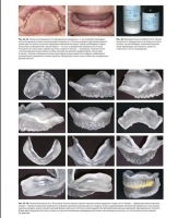 стандарт полного съёмного зубного протеза. автор: накагоми тасио