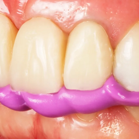 окклюфаст рок - винил-полисилоксан для регистрации окклюзии, 2*50мл., zhermack (тк=36уп)