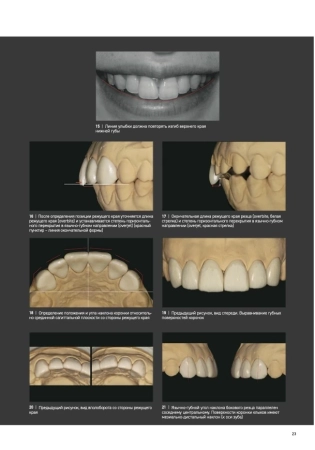 морфология зубов 2. the ultimate guide to tooth morphology 2. advance автор: вакита дайю