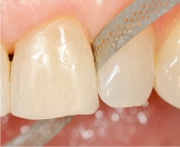 штрипсы металлические horico, 10шт., арт. f374d двухсторонние