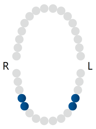 кламп для "раббердама" № 209 rubber dam clamp, dentech corporation