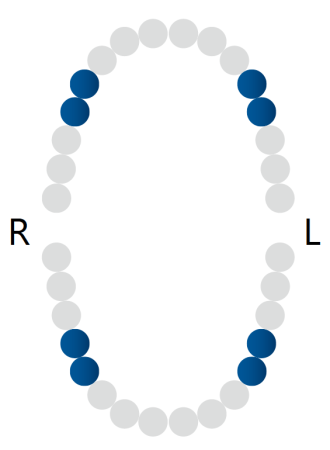 кламп для "раббердама" № 1at rubber dam clamp, dentech corporation