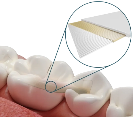 Dentapreg PFU - лента для шинирования 50мм*2мм*0.2мм (1 шт) ADM