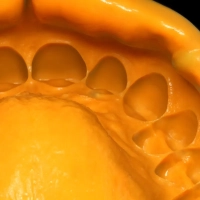 oranwash, 140мл, zhermack