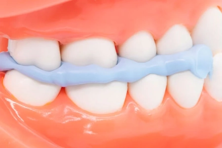 perfit bite registration fast set (type 0) - регистратор прикуса (2х50мл), huge