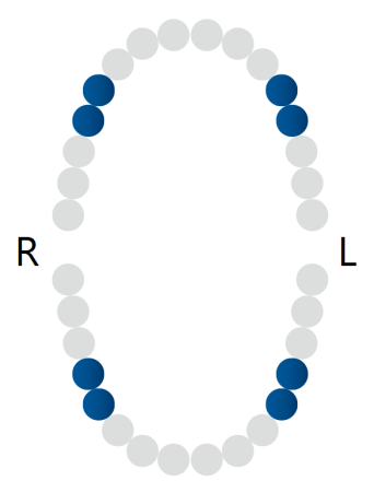 кламп для "раббердама" № 1t rubber dam clamp, dentech corporation