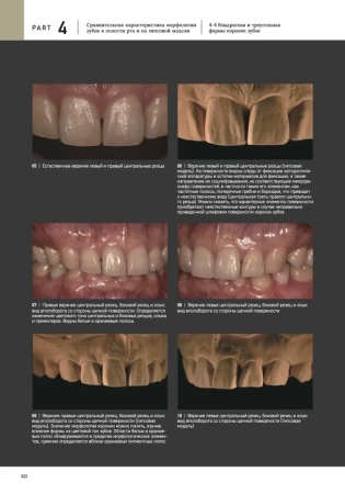 морфология зубов 2. the ultimate guide to tooth morphology 2. advance автор: вакита дайю