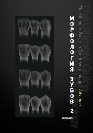 Морфология зубов 2. The Ultimate Guide to Tooth Morphology 2. Advance Автор: Вакита Дайю