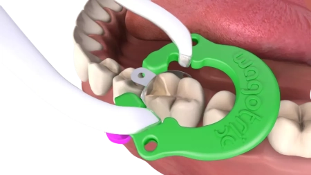 кольцо матричное wagotrix (зеленое)