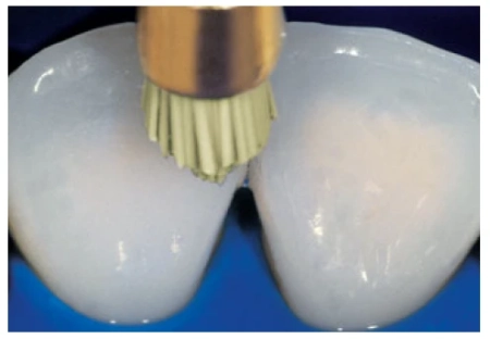 occlubrush point - щетки полировочные, 10шт., арт. 2512, kerr