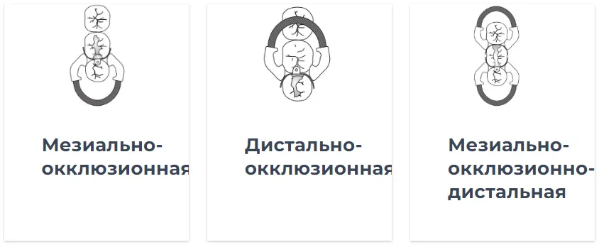 Palodent примеры использования.webp Palodent примеры использования.webp