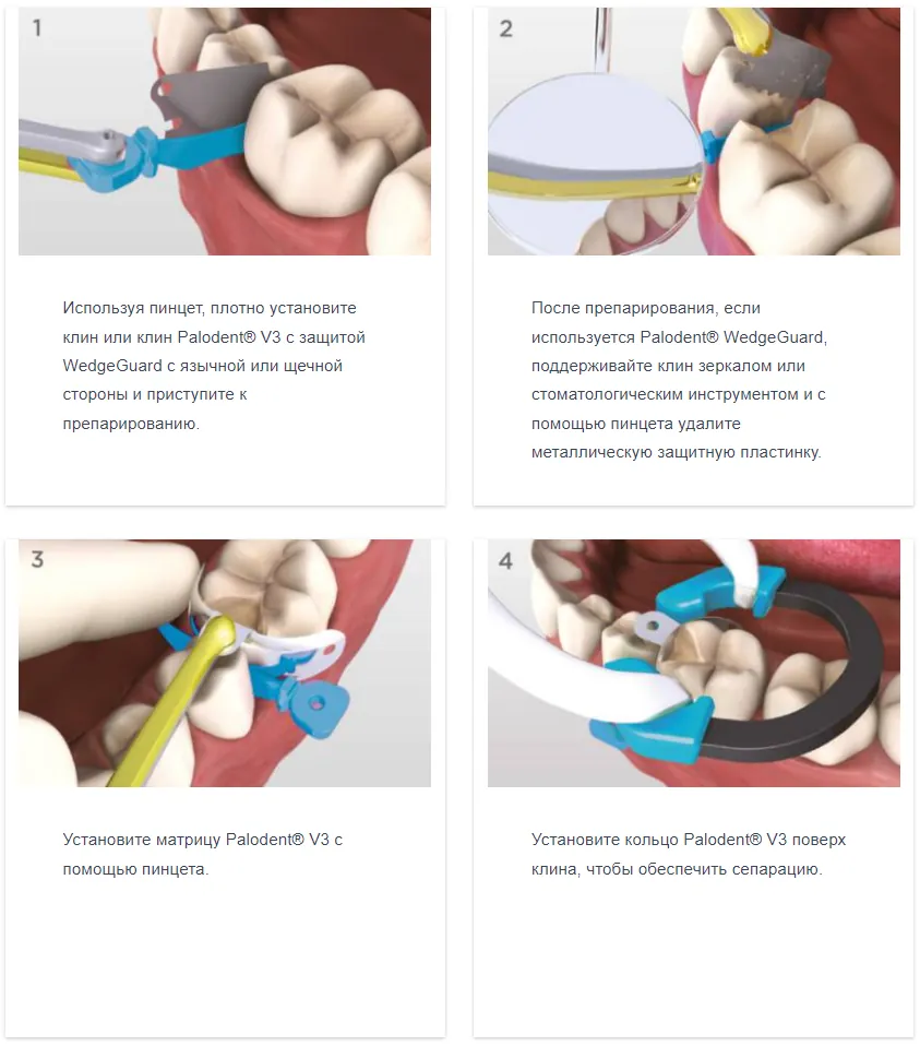 Palodent порядок применения.webp Palodent порядок применения.webp